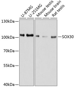 SOX30 Antibody in Western Blot (WB)