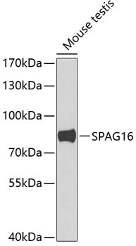 SPAG16 Antibody in Western Blot (WB)