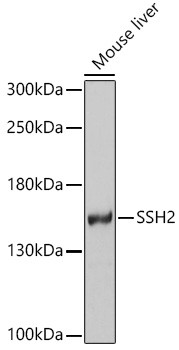SSH2 Antibody in Western Blot (WB)