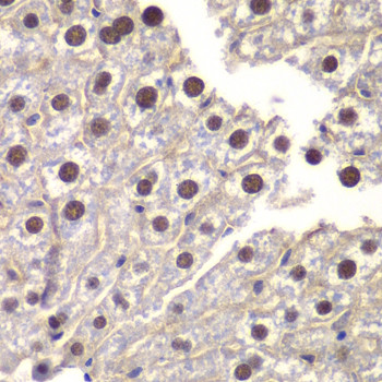 ST14 Antibody in Immunohistochemistry (Paraffin) (IHC (P))