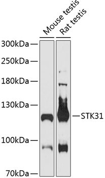 STK31 Antibody in Western Blot (WB)