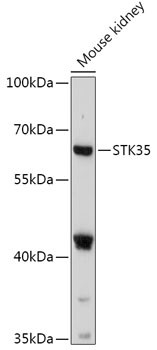 STK35 Antibody in Western Blot (WB)