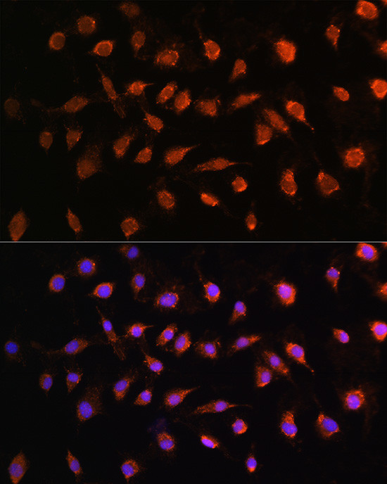 STK38 Antibody in Immunocytochemistry (ICC/IF)