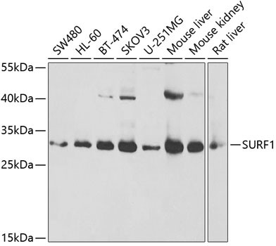 SURF1 Antibody in Western Blot (WB)