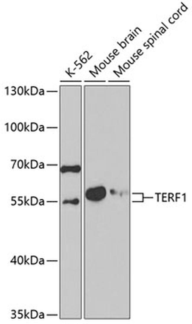 TERF1 Antibody in Western Blot (WB)