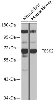 TESK2 Antibody in Western Blot (WB)
