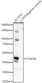 TFAP2B Antibody in Western Blot (WB)