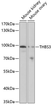 Thrombospondin 3 Antibody in Western Blot (WB)
