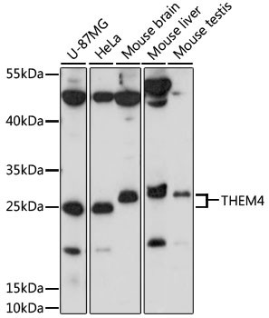 THEM4 Antibody in Western Blot (WB)