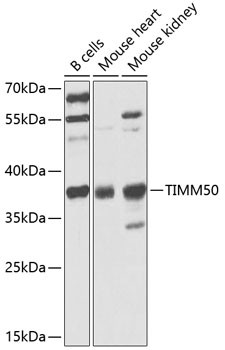TIMM50 Antibody in Western Blot (WB)