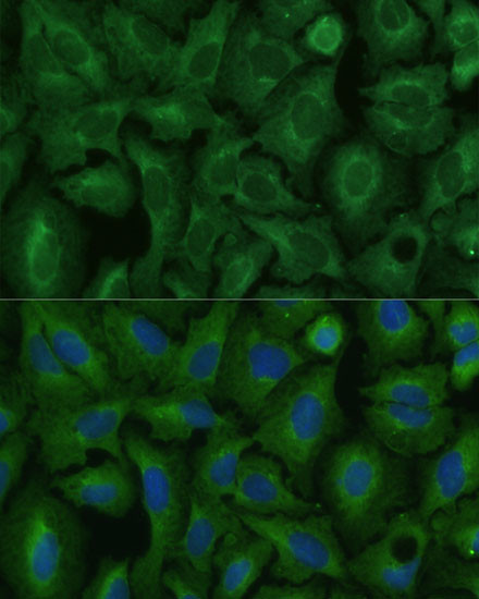 TIMM8B Antibody in Immunocytochemistry (ICC/IF)