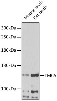 TMC5 Antibody in Western Blot (WB)