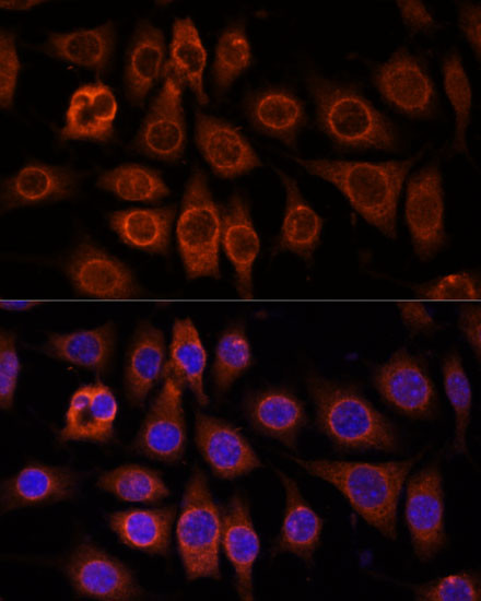 TMEM11 Antibody in Immunocytochemistry (ICC/IF)
