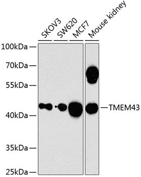 TMEM43 Antibody in Western Blot (WB)
