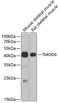 TMOD4 Antibody in Western Blot (WB)