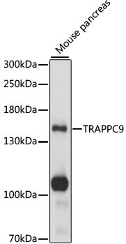NIBP Antibody in Western Blot (WB)
