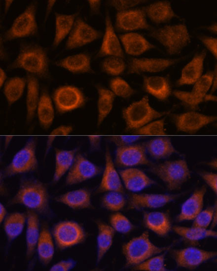 TRIM16 Antibody in Immunocytochemistry (ICC/IF)