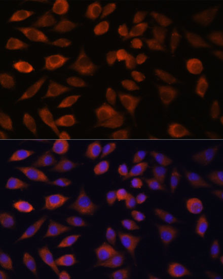 TRIM47 Antibody in Immunocytochemistry (ICC/IF)