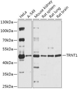 TRNT1 Antibody in Western Blot (WB)