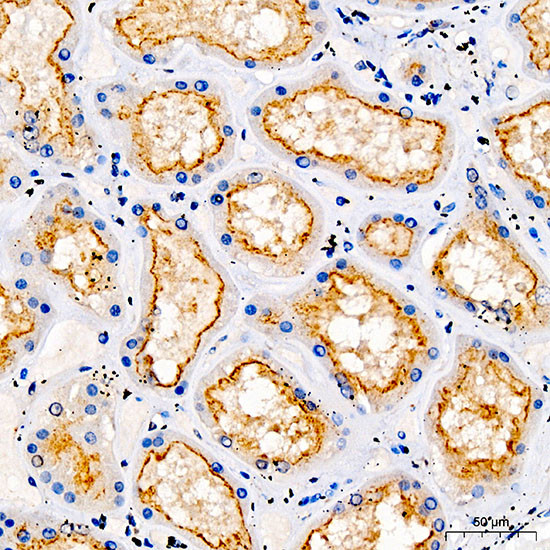 TRPV5 Antibody in Immunohistochemistry (Paraffin) (IHC (P))