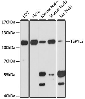 TSPYL2 Antibody in Western Blot (WB)