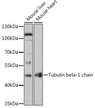 TUBB1 Antibody in Western Blot (WB)