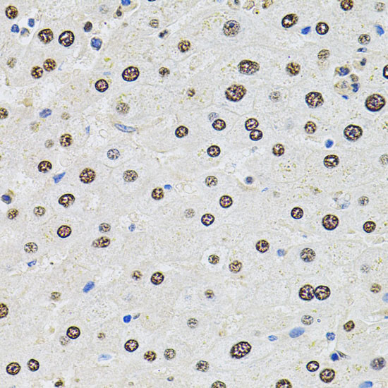 SR140 Antibody in Immunohistochemistry (Paraffin) (IHC (P))