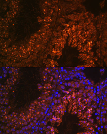 UBQLN3 Antibody in Immunohistochemistry (Paraffin) (IHC (P))