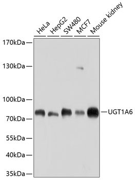 UGT1A6 Antibody in Western Blot (WB)