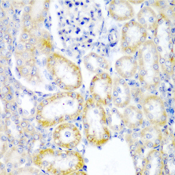 UPF2 Antibody in Immunohistochemistry (Paraffin) (IHC (P))