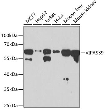 VIPAS39 Antibody in Western Blot (WB)