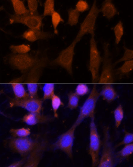 VPS26A Antibody in Immunocytochemistry (ICC/IF)