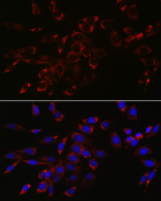 VPS4A Antibody in Immunocytochemistry (ICC/IF)