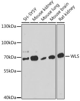 GPR177 Antibody in Western Blot (WB)