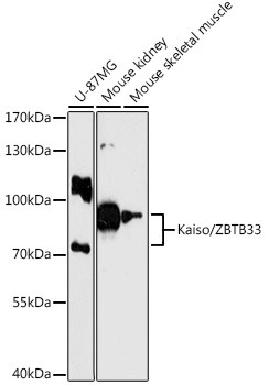 Kaiso Antibody in Western Blot (WB)