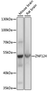 ZNF124 Antibody in Western Blot (WB)