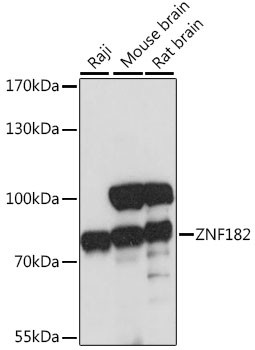 ZNF182 Antibody in Western Blot (WB)