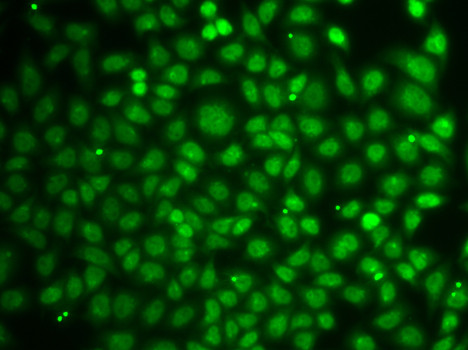 ZNF346 Antibody in Immunocytochemistry (ICC/IF)