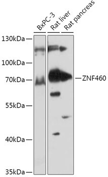 ZNF460 Antibody in Western Blot (WB)