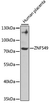 ZNF549 Antibody in Western Blot (WB)