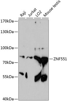ZNF551 Antibody in Western Blot (WB)