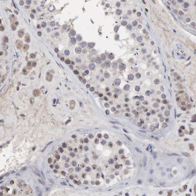 DKC1 Antibody in Immunohistochemistry (Paraffin) (IHC (P))