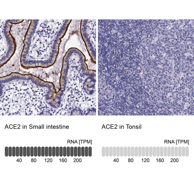 ACE2 Antibody in Immunohistochemistry (Paraffin) (IHC (P))
