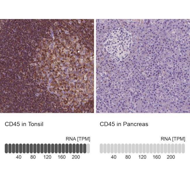 CD45 Antibody in Immunohistochemistry (Paraffin) (IHC (P))