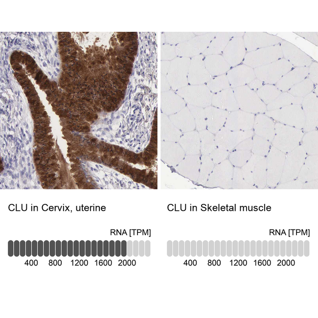 Apolipoprotein J Antibody in Immunohistochemistry (Paraffin) (IHC (P))