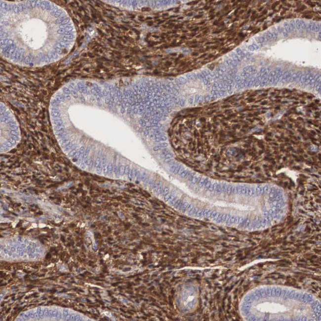 Galectin 1 Antibody in Immunohistochemistry (Paraffin) (IHC (P))