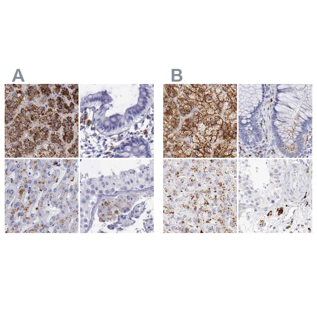alpha Galactosidase Antibody in Immunohistochemistry (Paraffin) (IHC (P))