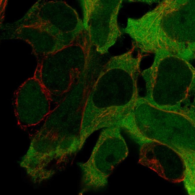 Creatine Kinase BB Antibody in Immunocytochemistry (ICC/IF)