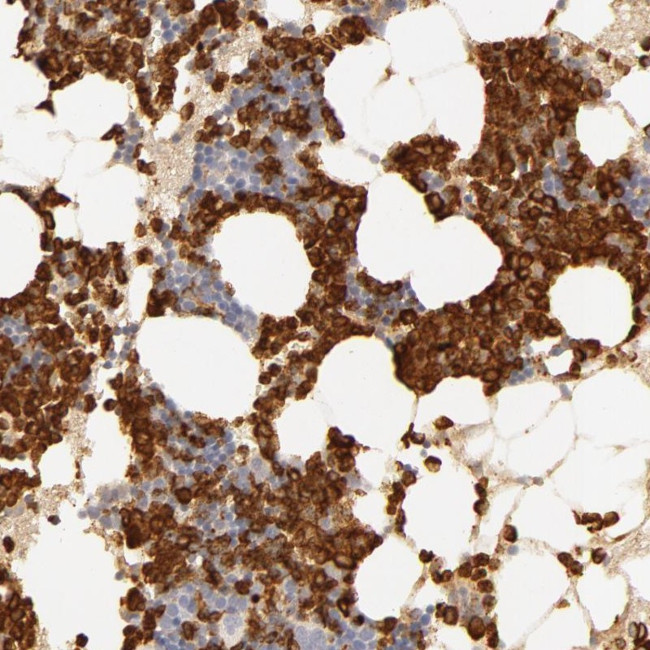 C1r Antibody in Immunohistochemistry (Paraffin) (IHC (P))