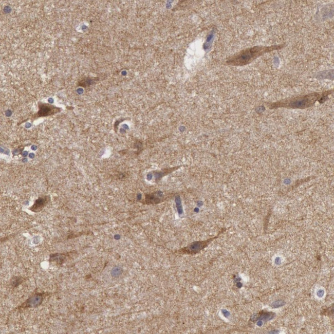 NLGN4X Antibody in Immunohistochemistry (Paraffin) (IHC (P))